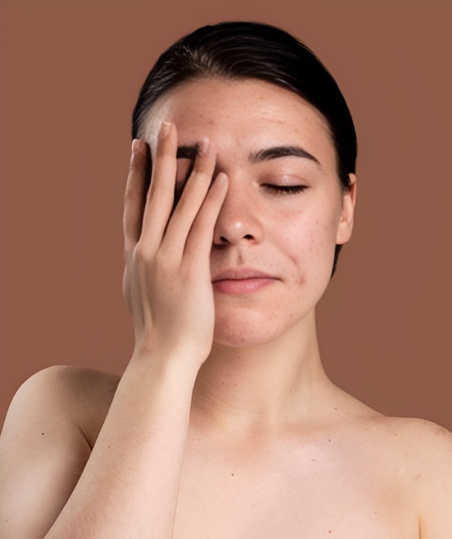Skin Diseases