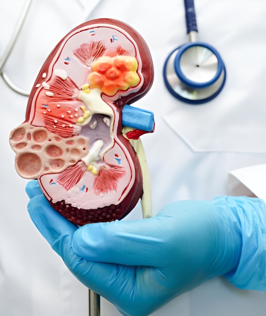 Chronic Kidney Disease